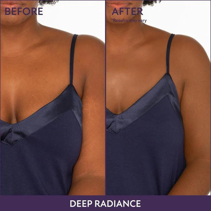 ⏳Last 30 Min ! Waterproof, lightweight – 🎉New Concealer Design + Exclusive Intro Offer!🔥 Beauty Body Coverage Perfector