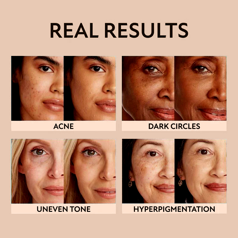 ⏳Last 30 Min ! Waterproof, lightweight – 🎉New Concealer Design + Exclusive Intro Offer!🔥 Beauty Body Coverage Perfector